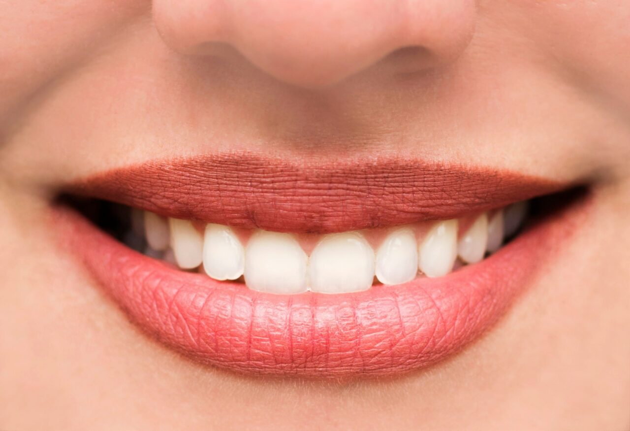 woman-s-lips-and-teeth-smile-close-up.jpg